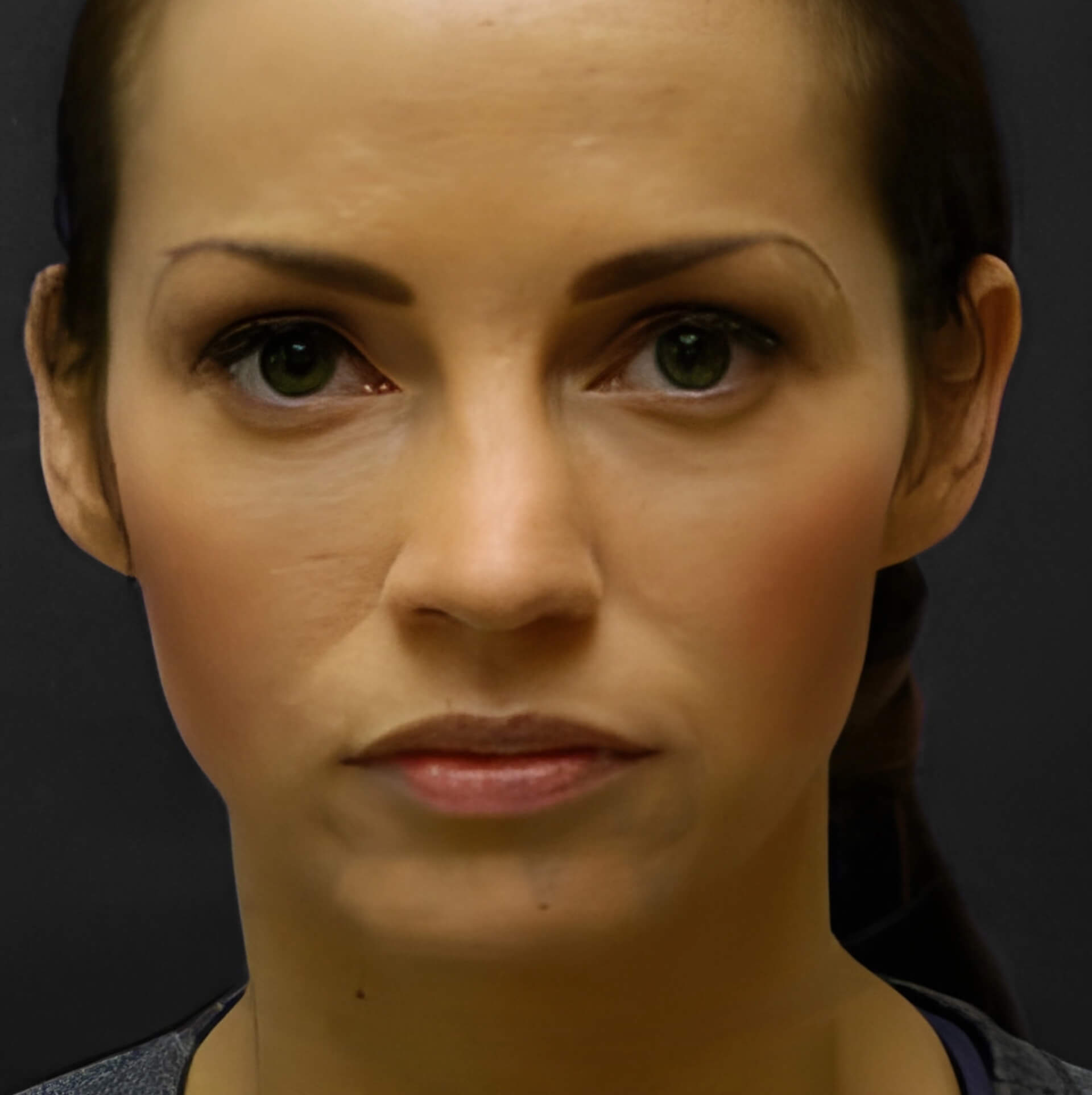 B&A - After