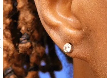 Earlobe Repair Before & After Patient #385