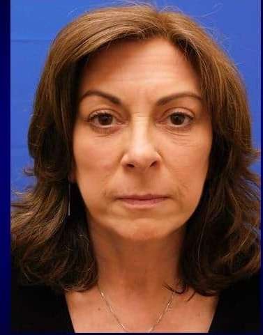 Makeover Before & After Patient #917