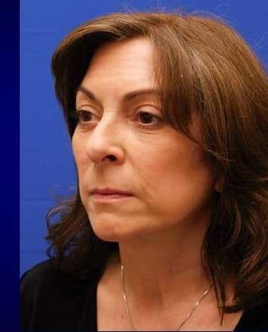 Makeover Before & After Patient #917