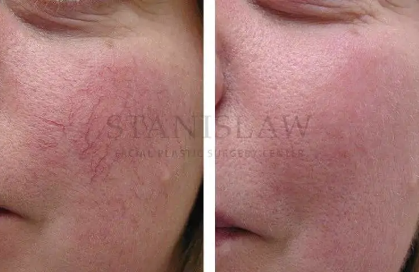 Skin Treatments & Lasers