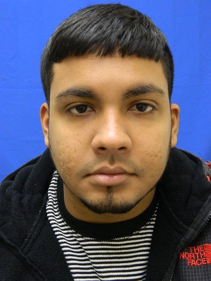 Acne Scarring Before & After Patient #9479