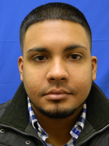 Acne Scarring Before & After Patient #9479
